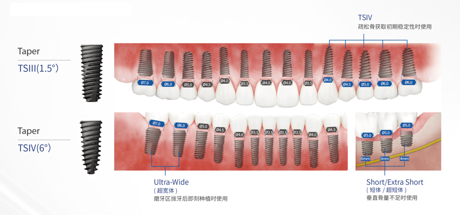 TS系列